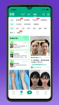 新氧極速版